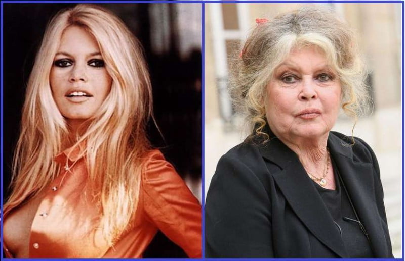 Brigitte Bardot dans Top 27 des célébrités qui ont super mal vieilli