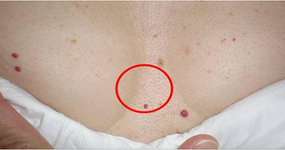 little pinpoint red dots on skin of toddler